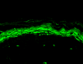 Nav1.8 Antibody (HRP)