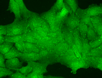 TRPC7 Antibody (PerCP)