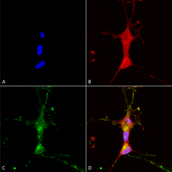 TRPC7 Antibody (RPE)
