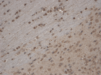 TRPC5 Antibody (APC)