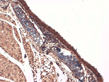Sodium Iodide Symporter Antibody (HRP)
