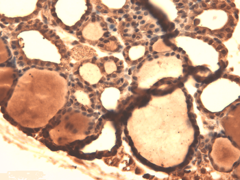 Sodium Iodide Symporter Antibody (HRP)