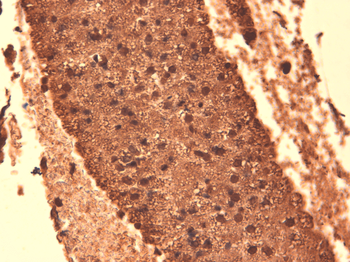 Sodium Iodide Symporter Antibody (PerCP)
