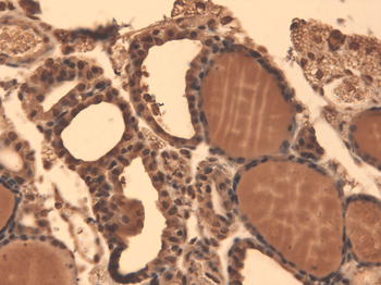 Sodium Iodide Symporter Antibody (HRP)