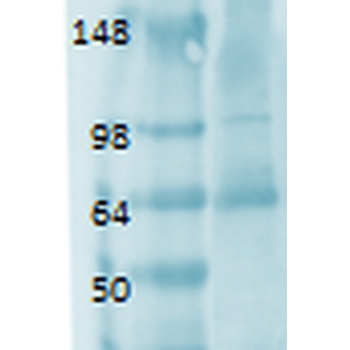 Sodium Iodide Symporter Antibody (HRP)
