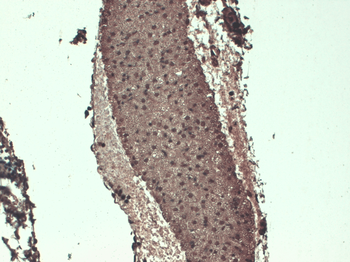 Sodium Iodide Symporter Antibody (PerCP)