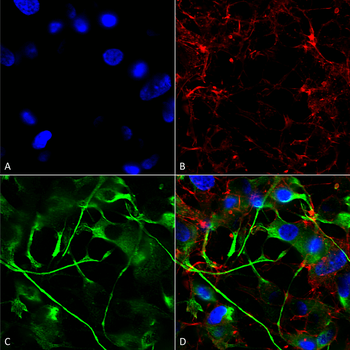VAChT Antibody (PerCP)