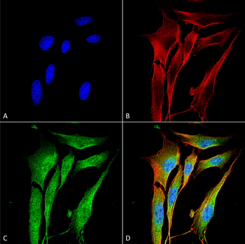 VAChT Antibody (RPE)