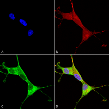 ATP7A Antibody (APC)