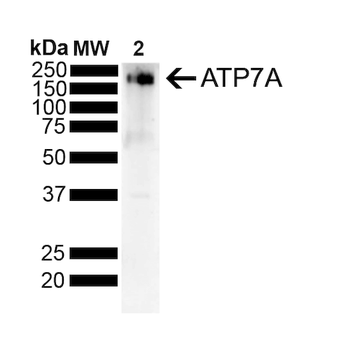 ATP7A Antibody (APC)