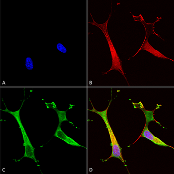 ATP7B Antibody (APC)