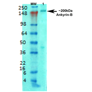 Ankyrin B Antibody (APC)
