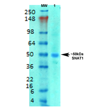 SLC38A1 Antibody (HRP)