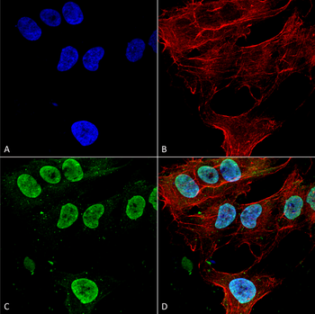 Cav3.1 Antibody (PerCP)