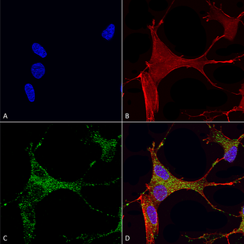 Cav3.1 Antibody (RPE)