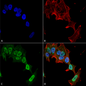 mGluR5 Antibody (RPE)