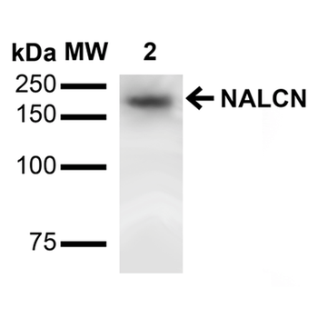 NALCN Antibody (APC)