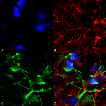 SUR2A Antibody (APC)