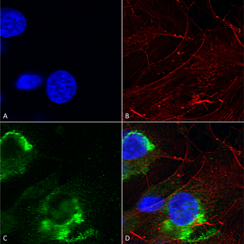 GFAP R416WT Antibody: RPE