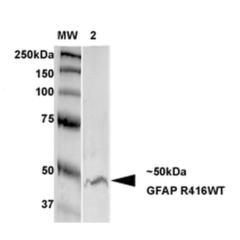 GFAP R416WT Antibody: RPE