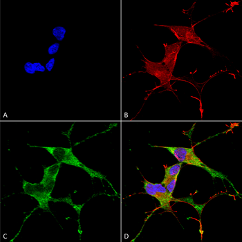LRRK2 Antibody (APC)