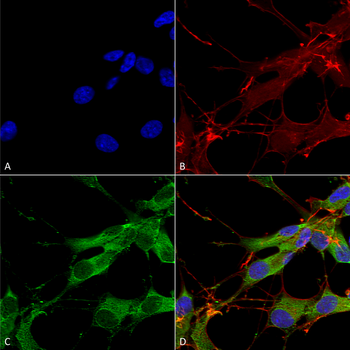 LRRK2 Antibody (APC)