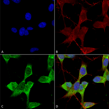 KCNK3 Antibody (APC)