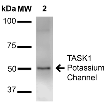 KCNK3 Antibody (APC)