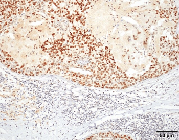 HSF1 Antibody: Biotin