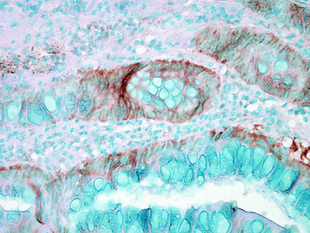HSP70 Antibody: APC