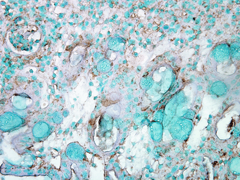 HSP70 Antibody: Biotin