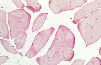 HSP27 Antibody: RPE