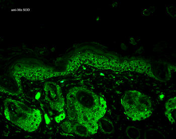 SOD2 (Mn) Antibody (APC)