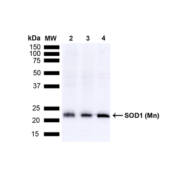 SOD2 (Mn) Antibody (Biotin)