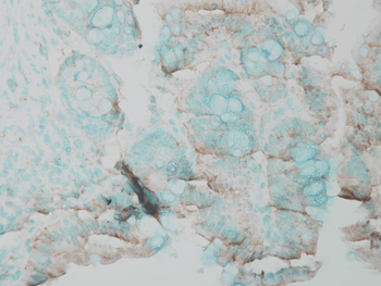 Erk1/2 Antibody: HRP