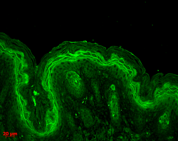 Erk1/2 Antibody: HRP