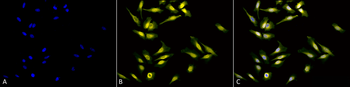 Calreticulin Antibody (FITC)