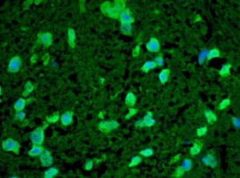HSP22 Antibody: Biotin