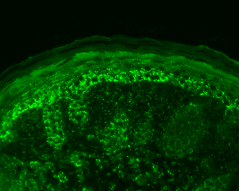Cpn10 Antibody (RPE)