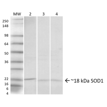 SOD1 (UbetaB) Antibody (Biotin)