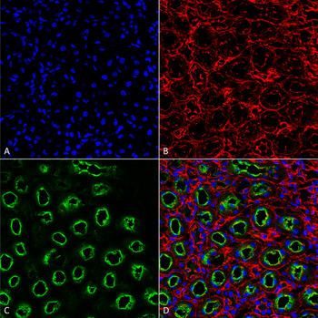 NKCC2 Antibody (FITC)