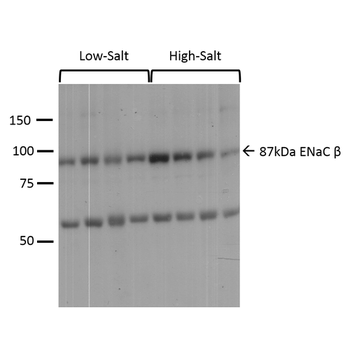ENaC beta Antibody (FITC)