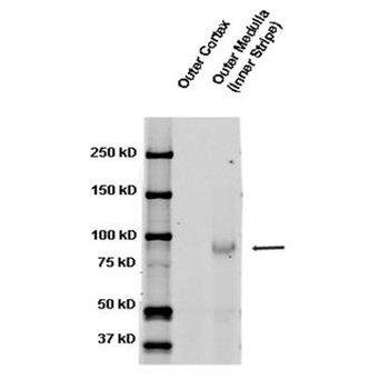 ENaC beta Antibody (HRP)