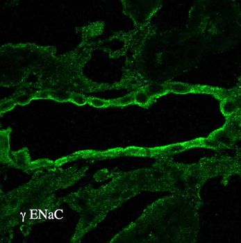 ENaC gamma Antibody (RPE)