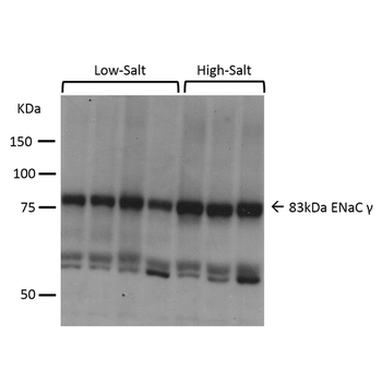 ENaC gamma Antibody (RPE)