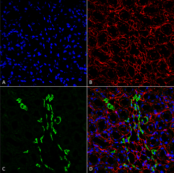 UT-A1 Antibody (APC)
