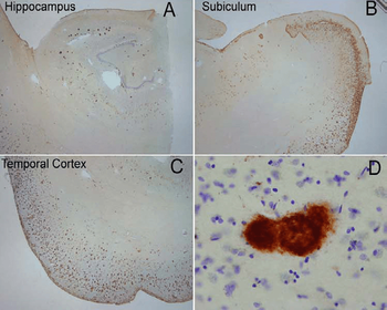 Amyloid Fibrils (OC) Antibody (APC)