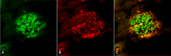Amyloid Fibrils (OC) Antibody (RPE)