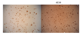 Amyloid Fibrils (OC) Antibody (RPE)