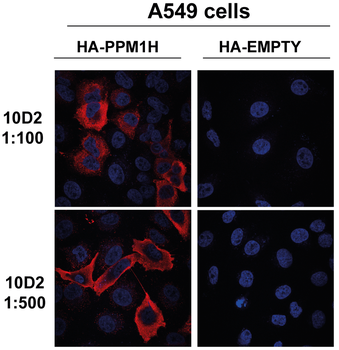 PPM1H Antibody (APC)